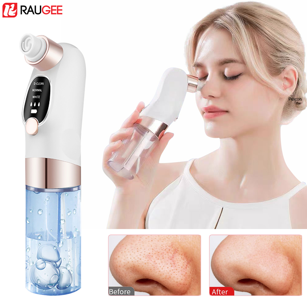 Blackhead Remover Electric Bla - Air Bubble Remover reseña y precio